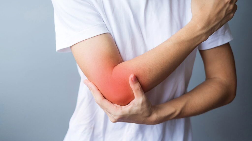 Essa lesão no cotovelo comum em atletas está afetando cada vez mais pessoas comuns