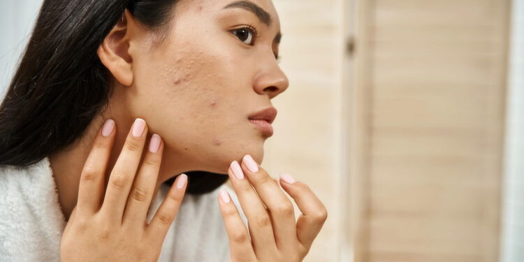 O hábito mais comum que pode ser o maior vilão da sua pele