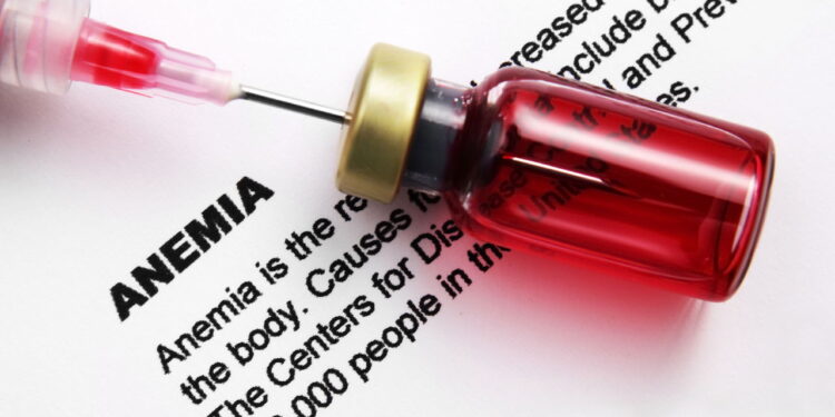 O sintoma mais ignorado da anemia pode estar atrapalhando seu dia a dia