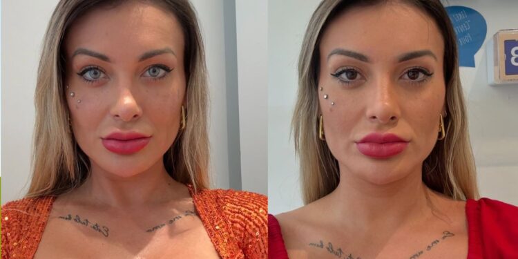 Conheça a cirurgia de mudança de cor dos olhos popular entre as famosas