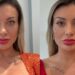 Conheça a cirurgia de mudança de cor dos olhos popular entre as famosas