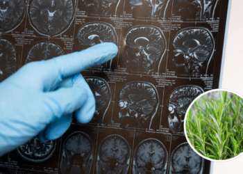 Essa erva está associada a melhorar a memória, reduzir a ansiedade e proteção contra o Alzheimer