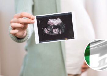 Esses nomes italianos têm raízes fortes e são perfeitos para seu bebê