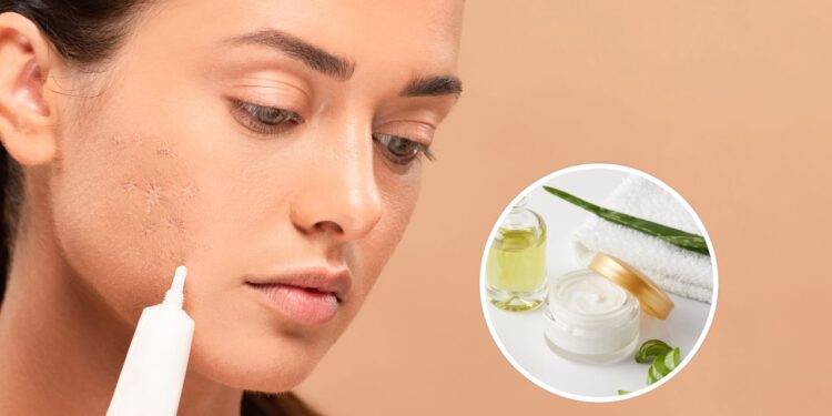 Saiba qual é o cicatrizante natural mais potente da natureza