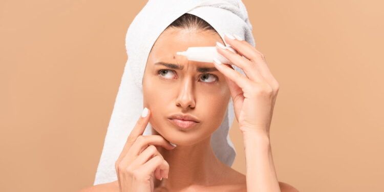 O mito da pasta de dente nas espinhas pode estar prejudicando sua pele