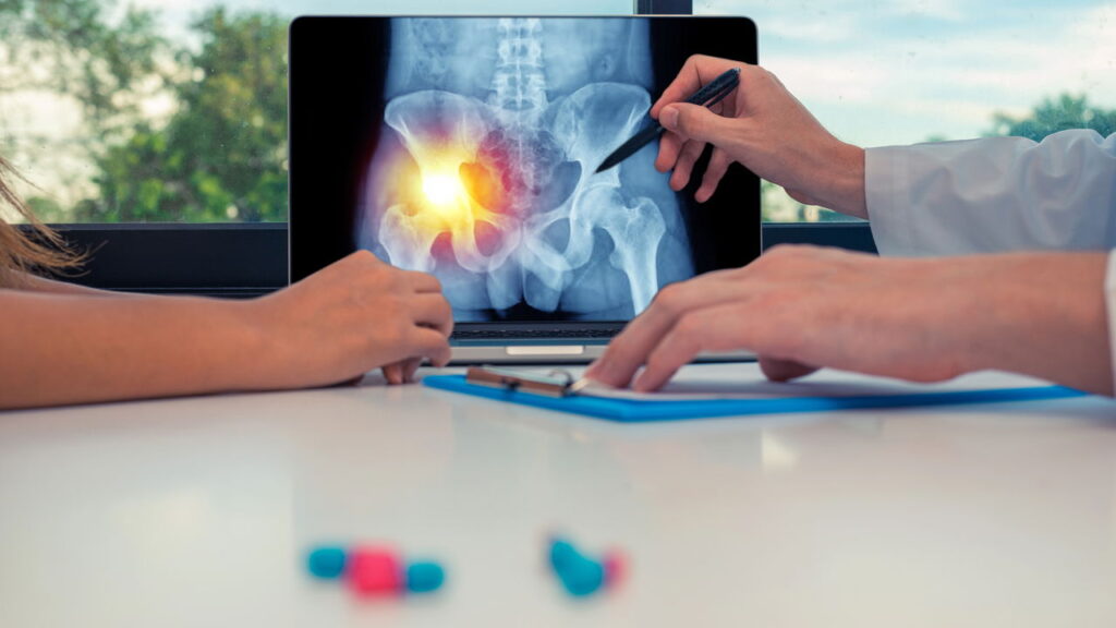 A técnica mais eficaz para evitar dor no quadril já faz sucesso em 2025