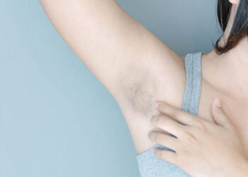 Você não vai acreditar no que essa mistura faz na pele escura