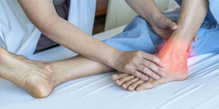 Fisioterapeutas alertam para aumento de lesões no tendão de Aquiles