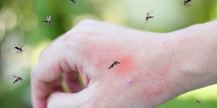 Adeus aos mosquitos: o truque caseiro para acabar com as picadas de uma vez por todas