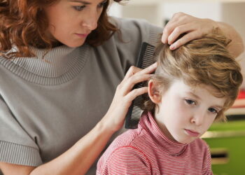 As 5 plantas para manter longe os piolhos