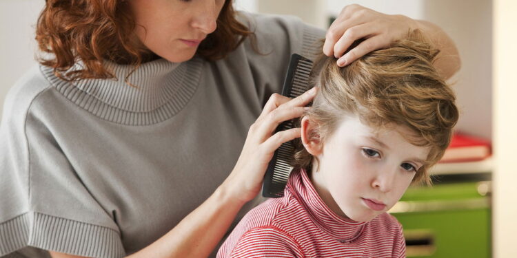 As 5 plantas para manter longe os piolhos