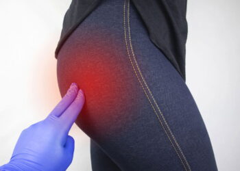 Artrose de quadril exige atenção aos sinais e cuidados específicos com o corpo