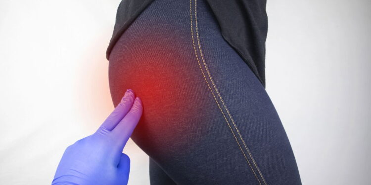 Artrose de quadril exige atenção aos sinais e cuidados específicos com o corpo