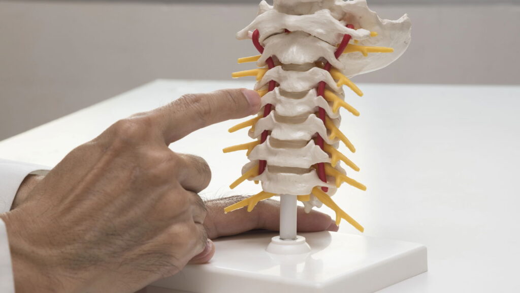 Com fisioterapia e colete ortopédico, muita gente consegue viver bem com escoliose