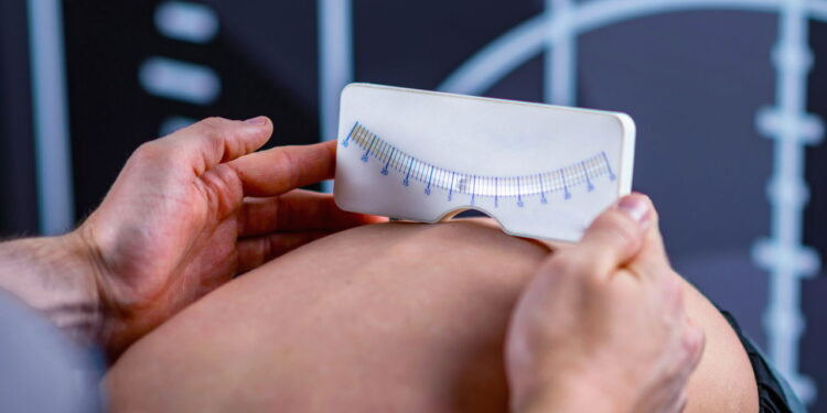 Dor nas costas e ombros tortos podem ser sinais de escoliose