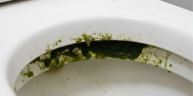 O truque simples que está sumindo com o limo do vaso sanitário