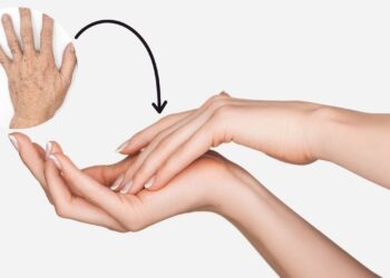 Como recuperar mãos secas e manchadas com rotina de cuidados naturais