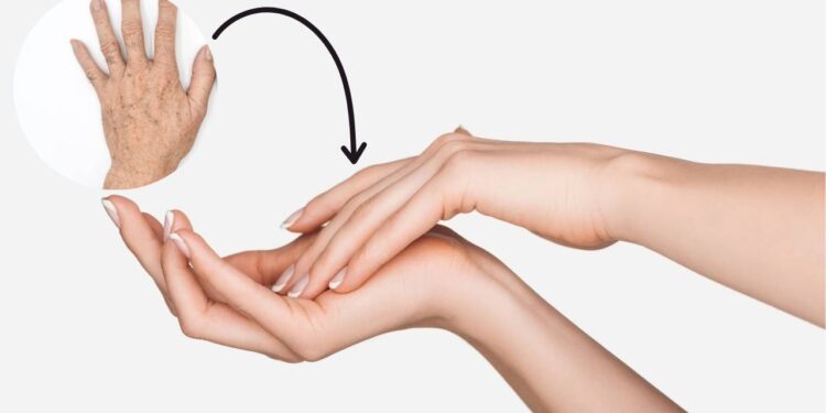 Como recuperar mãos secas e manchadas com rotina de cuidados naturais