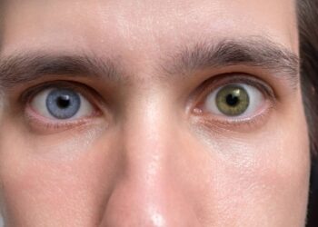 Por que algumas pessoas têm olhos de cores diferentes, segundo a ciência