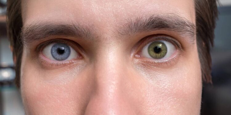 Por que algumas pessoas têm olhos de cores diferentes, segundo a ciência