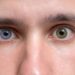 Por que algumas pessoas têm olhos de cores diferentes, segundo a ciência