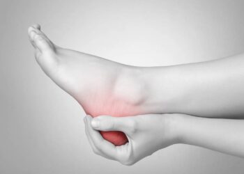 Quem sente dor no calcanhar precisa conhecer essas dicas fáceis para tratar a fascite plantar