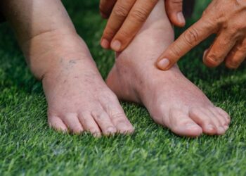 Como acabar com o inchaço e reduzir medidas rapidamente