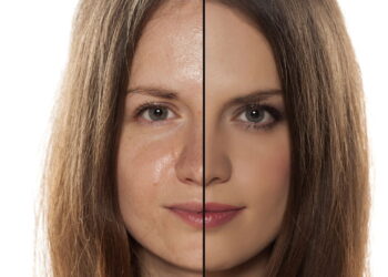 Pele oleosa também precisa de hidratação para ficar equilibrada e saudável