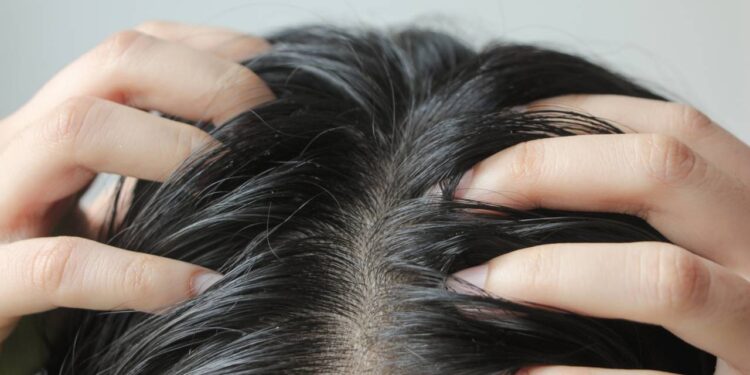 Como eliminar a oleosidade do cabelo em apenas 5 minutos