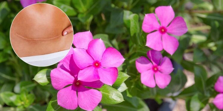 Esta flor medicinal trata dermatite e cicatriza feridas