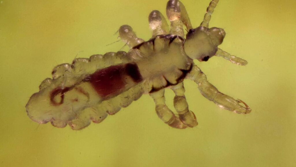 Proteja suas crianças dos piolhos neste verão com truques caseiros que funcionam