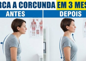 Exercícios para melhorar a postura e perder a corcunda em 3 meses