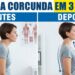 Exercícios para melhorar a postura e perder a corcunda em 3 meses
