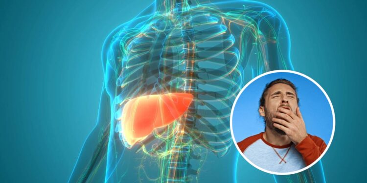 A gordura no fígado se manifesta silenciosamente e os sintomas são frequentemente ignorados