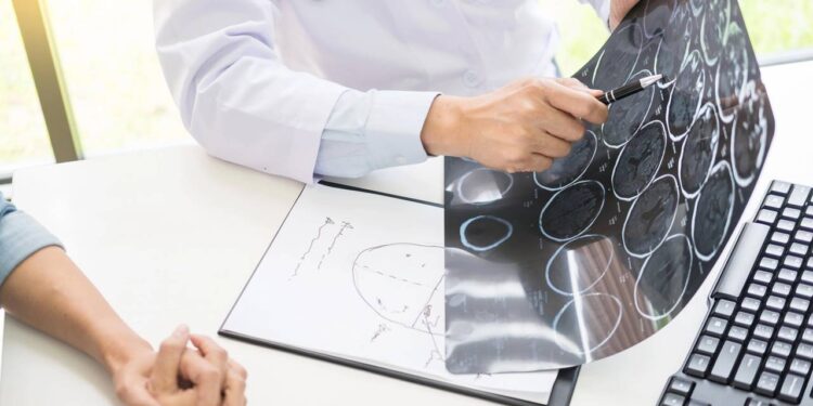 Os quatro hábitos de vida mais eficazes que previnem um AVC, segundo neurocirurgião