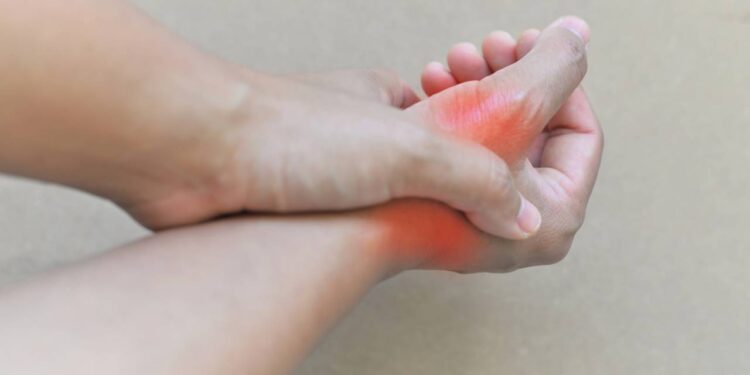 Acabe com a tendinite na mão com exercícios caseiros