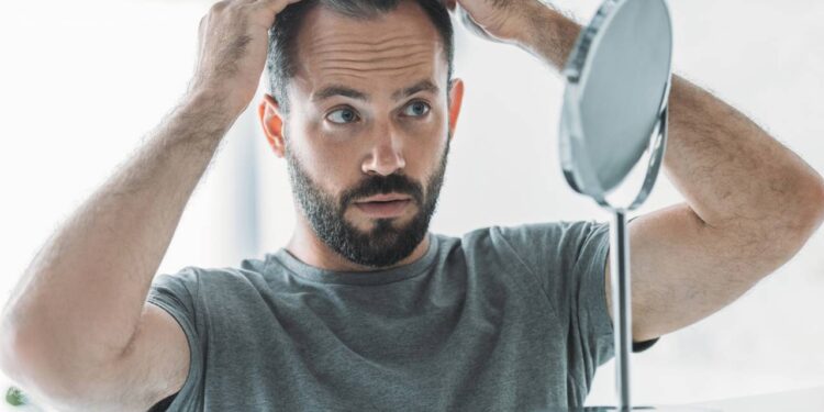 Mitos sobre a calvície e como especialistas explicam a queda
