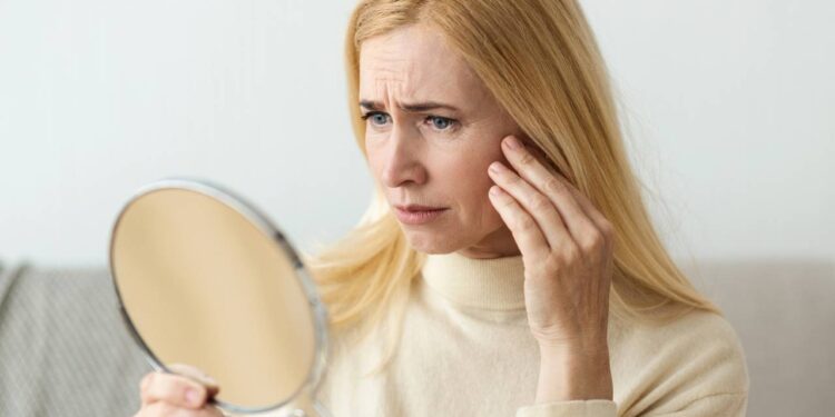 Como lidar com rugas e flacidez na pele, depois dos 45