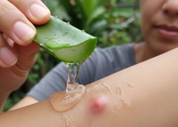 Poucas pessoas sabem disso, mas estas plantas aliviam coceira causada por picadas de insetos e reduzem a inflamação da pele