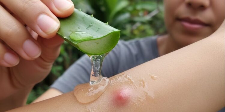 Poucas pessoas sabem disso, mas estas plantas aliviam coceira causada por picadas de insetos e reduzem a inflamação da pele