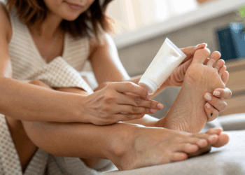 O creme caseiro para rachadura nos pés que ajuda no ressecamento, mas exige cuidados