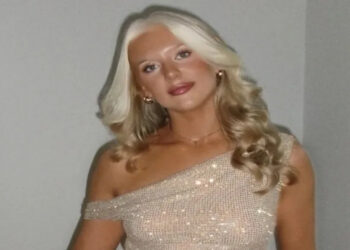 Chamavam de “texugo” na escola, mas hoje ela aprendeu a amar o próprio cabelo