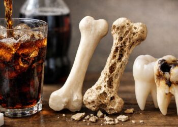 Beber refrigerante todos os dias pode enfraquecer ossos e dentes, veja o que a ciência diz