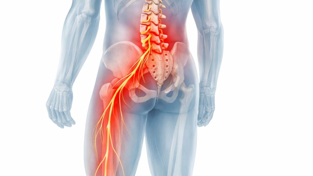 Dor nas costas e dormência nas pernas depois de um dia cansativo: quando se deve consultar um médico
