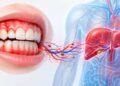 5 sinais na gengiva que podem indicar inflamação no fígado e você nem percebe