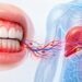 5 sinais na gengiva que podem indicar inflamação no fígado e você nem percebe