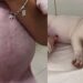 Tutora leva cachorrinha desesperada à clínica após barriga crescer muito do nada