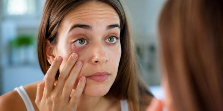 Deficiência de ferro: 3 sinais no corpo que aparecem no espelho e quase ninguém percebe