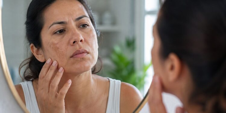 5 sinais na pele que podem indicar diabetes não controlada antes mesmo do diagnóstico médico