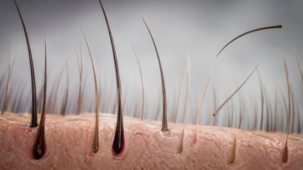 Queda de cabelo fora do normal: 5 sinais de que algo está errado no corpo